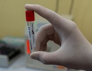 В Петербурге выявили еще 2 632 случая коронавируса