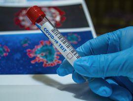 Число зараженных коронавирусом  в России за сутки сократилось до 6 207 человек