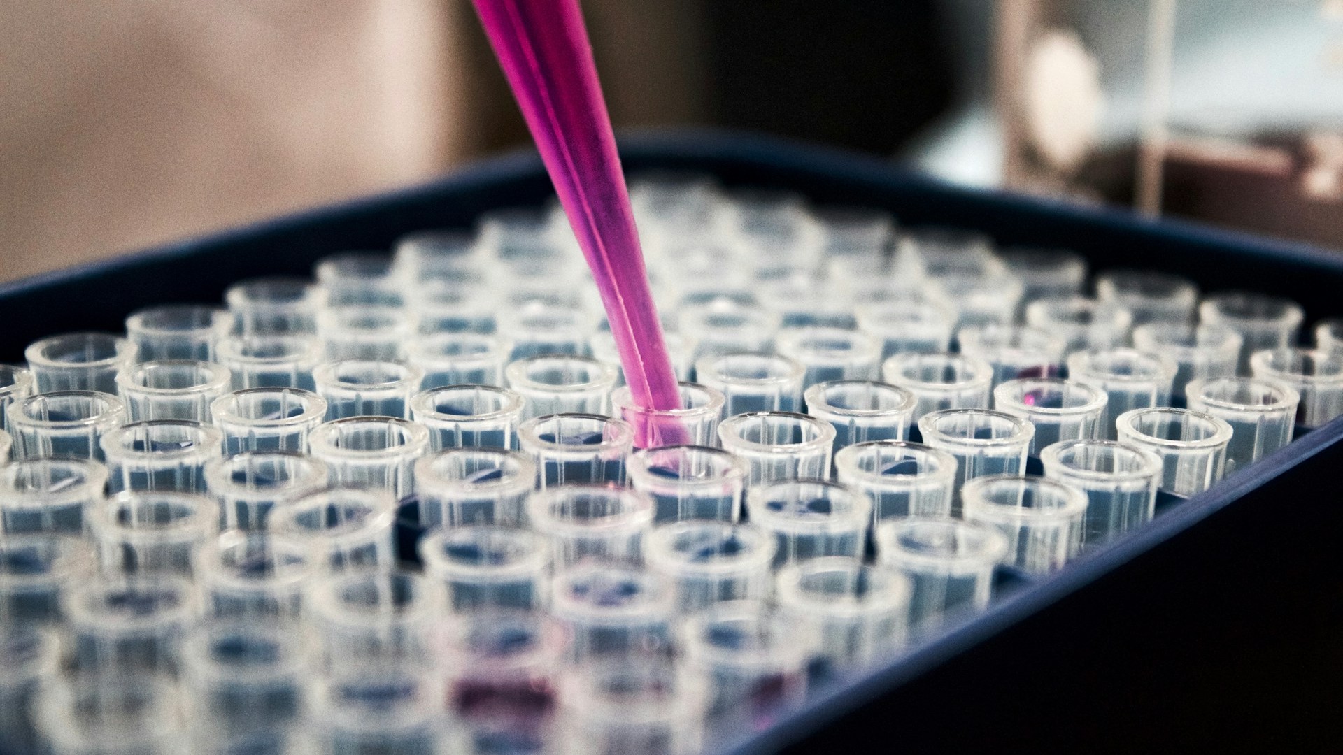 Более 2 тыс. новых случаев ВИЧ выявили в Петербурге в 2024 году